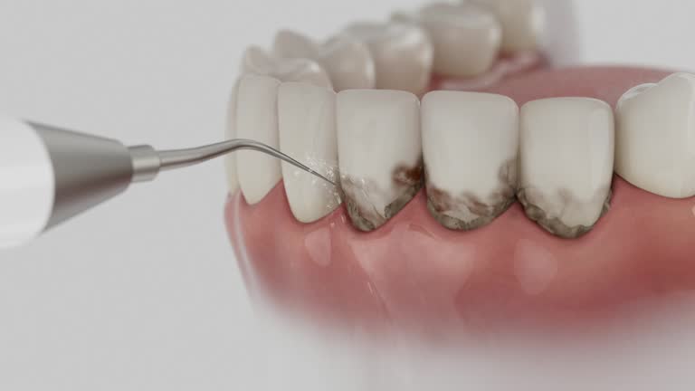 Trusted Teeth Cleaning And Checkup service in Kearney, MO - Dentist Open Now